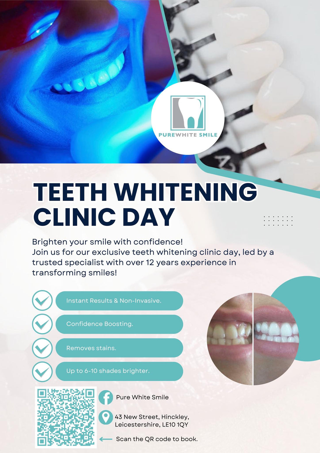 Teeth Whitening Clinic Days!